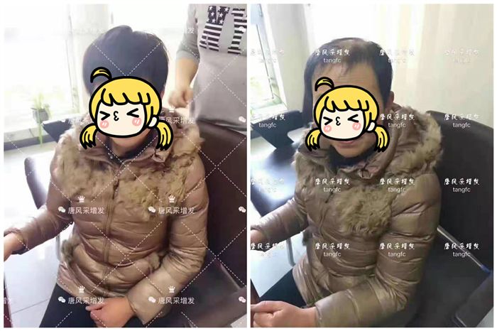 短发假发发型_假发短发女卷发_时尚假发短发烫发