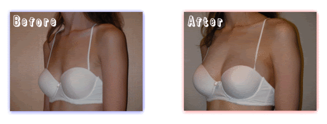 微乳才是时尚-微乳时尚圈(图10) 微乳才是时尚_微乳时尚圈_微乳穿衣服好看